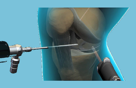 Orthopedic Specialist in bangalore